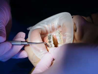 Signs You Might Need Orthodontic Treatment in El Paso